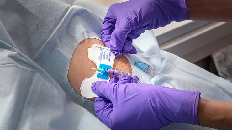 <h3>SECURE the catheter</h3>
<p>Secure the position of the catheter at the site to reduce the risk of dislodgment. Using adhesive-based ESDs or device stabilization devices that may reduce risk of infection and catheter dislodgment.<sup>2*</sup></p>
<p><sup>2*. Infusion Nurses Society. Infusion Therapy Standards of Practice. J Infus Nurs. 2016; 39(1S): S73.</sup></p>
<p><a href="/content/bd-com/ga/anz/en-anz/products-and-solutions/solutions/vascular-access-management.html" title="Link to form on Partner with BD page" target="_self" rel="noopener noreferrer"><span class="forward-arrow-icon-boosted-blue">Let us help identify the gaps in your clinical practice</span></a></p>
